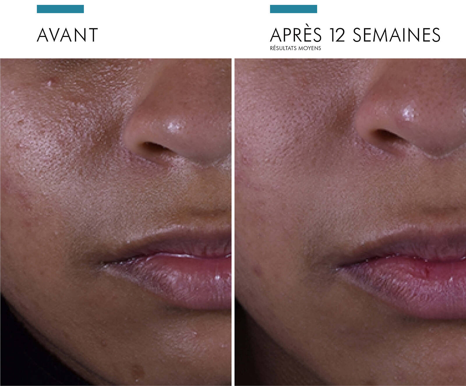 SkinCeuticals - Silymarin CF® - Espace Skins Montreal